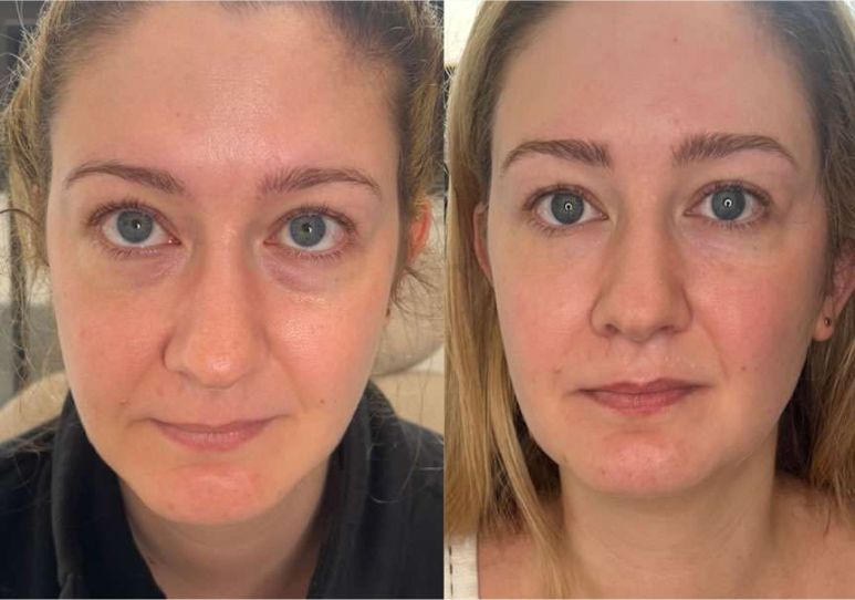 Comparison of two facial appearances side by side.